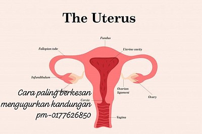 PIL misoprostol mampu mengakhiri Kandungan anda